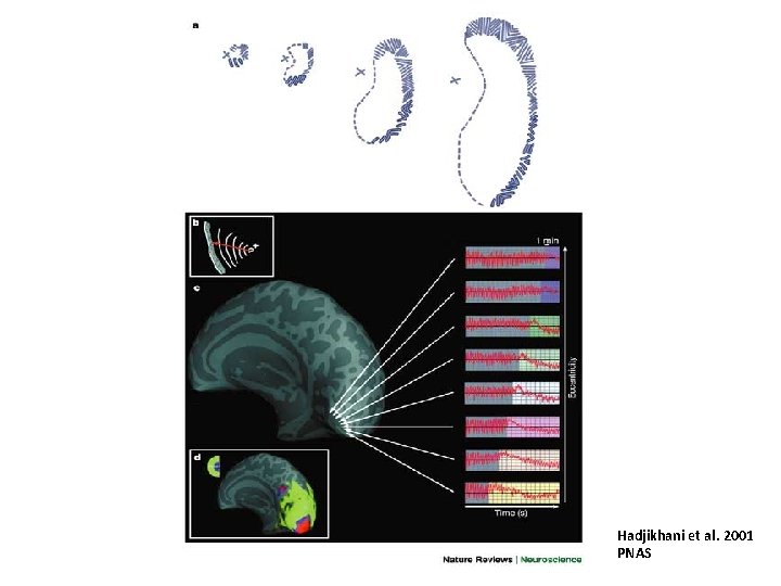 Hadjikhani et al. 2001 PNAS 