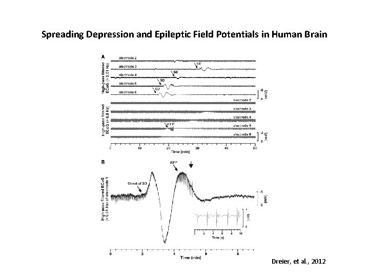 Spreading Depression and Epileptic Field Potentials in Human Brain Dreier, et al. , 2012