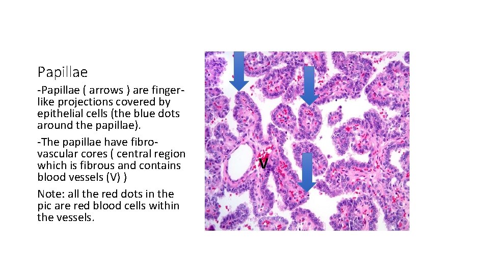 Papillae -Papillae ( arrows ) are fingerlike projections covered by epithelial cells (the blue