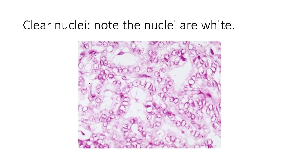 Clear nuclei: note the nuclei are white. 