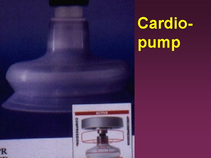 Cardiopump 