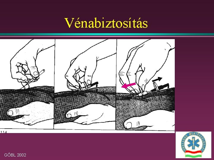 Vénabiztosítás GŐBL 2002 