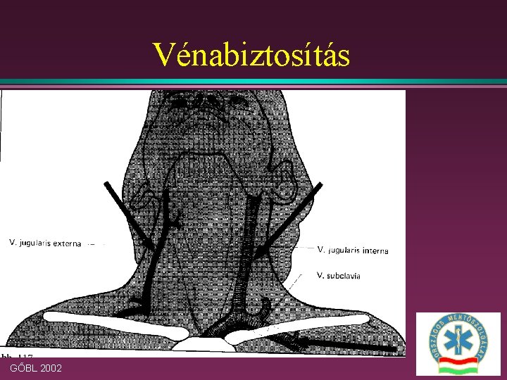 Vénabiztosítás GŐBL 2002 