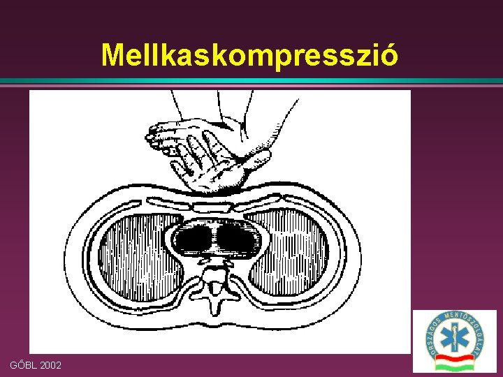 Mellkaskompresszió GŐBL 2002 