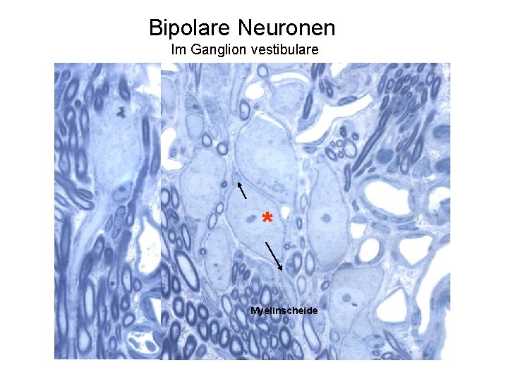 Bipolare Neuronen Im Ganglion vestibulare * Myelinscheide 