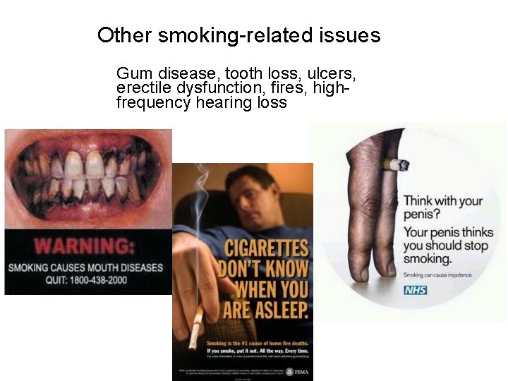 Other smoking-related issues Gum disease, tooth loss, ulcers, erectile dysfunction, fires, highfrequency hearing loss