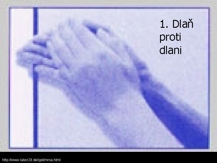 1. Dlaň proti dlani http: //www. labor 28. de/igel/mrsa. html 