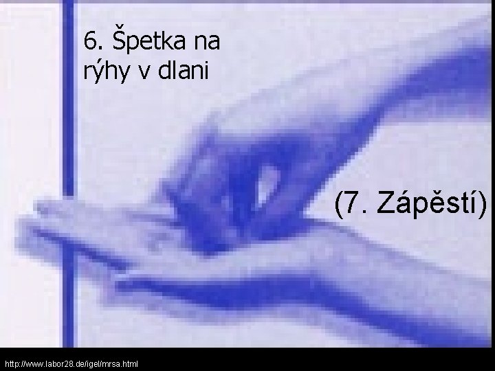 6. Špetka na rýhy v dlani (7. Zápěstí) http: //www. labor 28. de/igel/mrsa. html