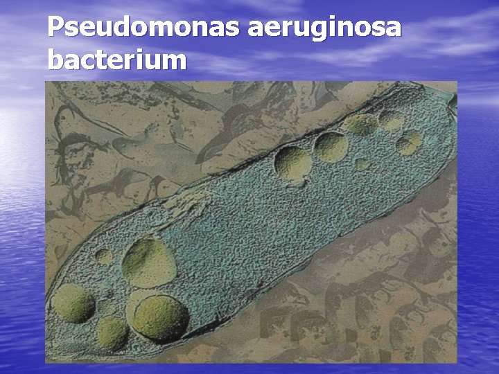 Pseudomonas aeruginosa bacterium 
