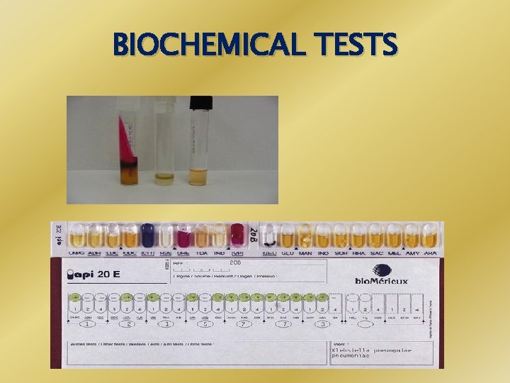 BIOCHEMICAL TESTS 