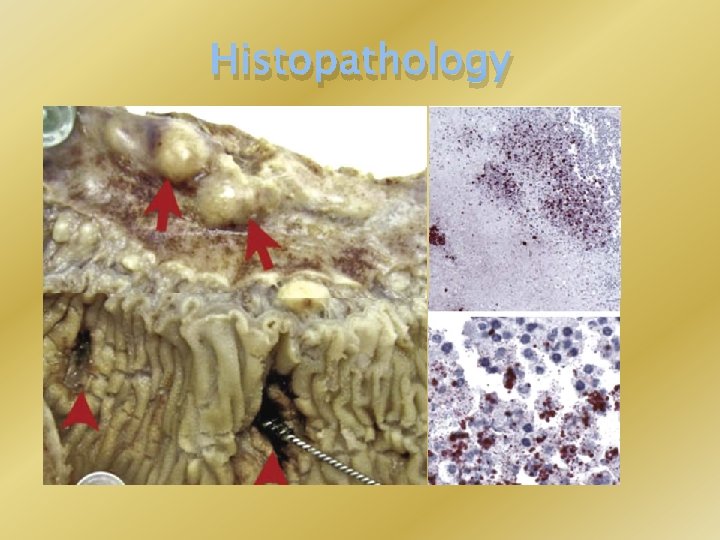 Histopathology 