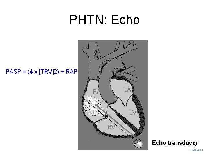 PHTN: Echo PASP = (4 x [TRV]2) + RAP LA RA LV RV Echo