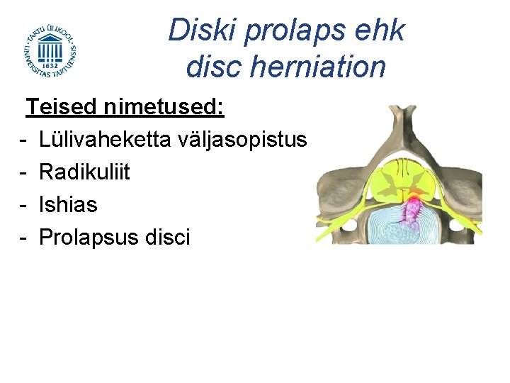 Diski prolaps ehk disc herniation Teised nimetused: - Lülivaheketta väljasopistus - Radikuliit - Ishias