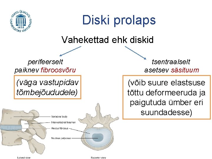 Diski prolaps Vahekettad ehk diskid perifeerselt paiknev fibroosvõru (väga vastupidav tõmbejõududele) tsentraalselt asetsev säsituum