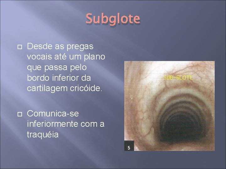 Subglote Desde as pregas vocais até um plano que passa pelo bordo inferior da