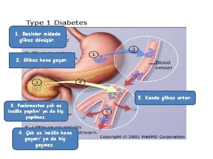 1. Besinler midede glikoz dönüşür. 2. Glikoz kana geçer. 5. Kanda glikoz artar. 3.