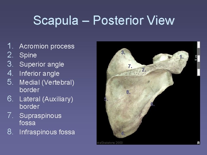 Scapula – Posterior View 1. 2. 3. 4. 5. Acromion process Spine Superior angle