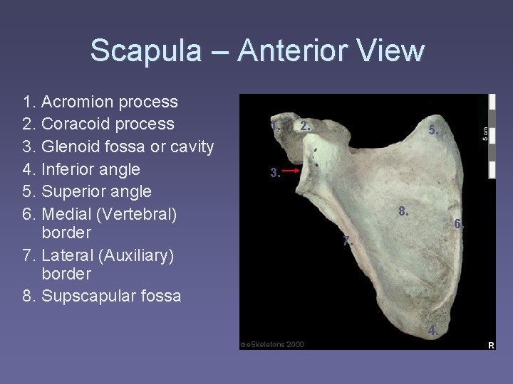 Scapula – Anterior View 1. Acromion process 2. Coracoid process 3. Glenoid fossa or