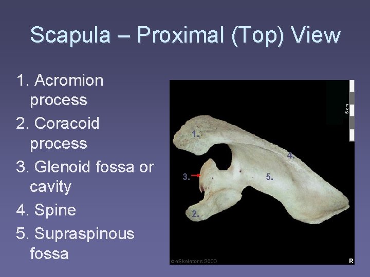 Scapula – Proximal (Top) View 1. Acromion process 2. Coracoid process 3. Glenoid fossa