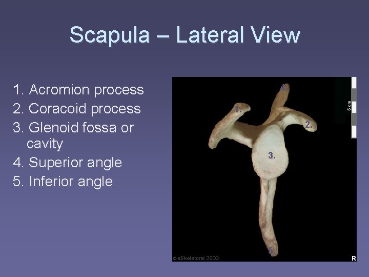 Scapula – Lateral View 1. Acromion process 2. Coracoid process 3. Glenoid fossa or