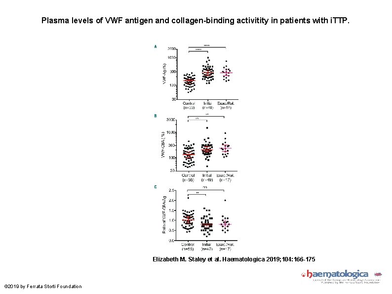 Plasma levels of VWF antigen and collagen-binding activitity in patients with i. TTP. Elizabeth