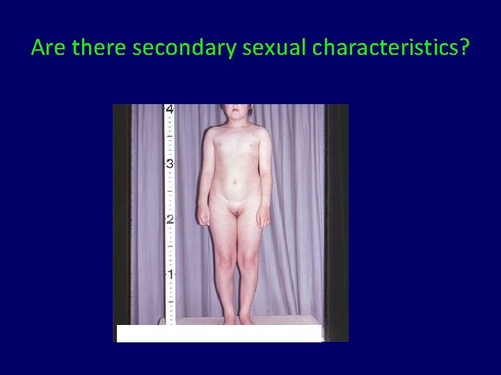 Are there secondary sexual characteristics? 