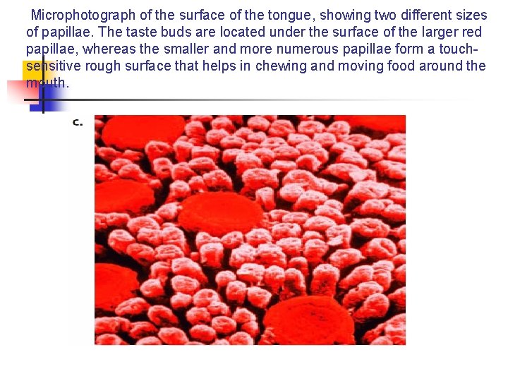 Microphotograph of the surface of the tongue, showing two different sizes of papillae. The