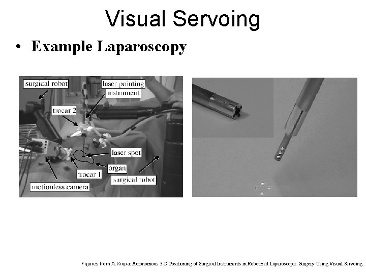 Visual Servoing • Example Laparoscopy Figures from A. Krupa: Autonomous 3 -D Positioning of