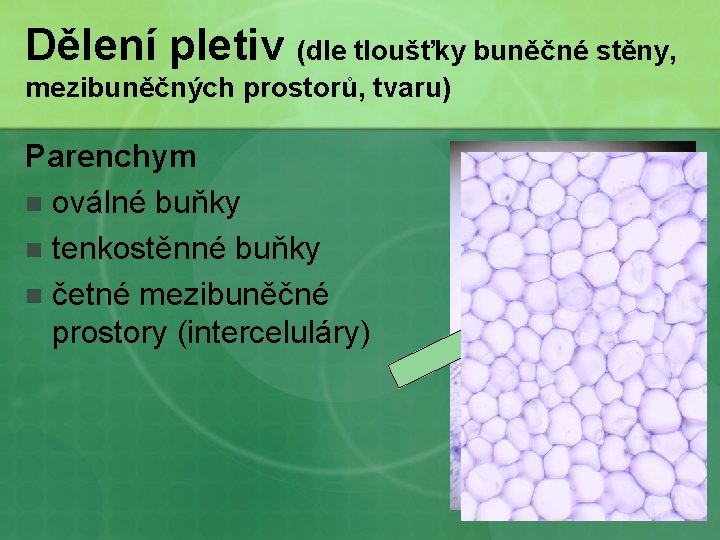 Dělení pletiv (dle tloušťky buněčné stěny, mezibuněčných prostorů, tvaru) Parenchym n oválné buňky n
