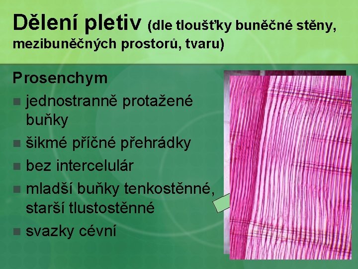 Dělení pletiv (dle tloušťky buněčné stěny, mezibuněčných prostorů, tvaru) Prosenchym n jednostranně protažené buňky