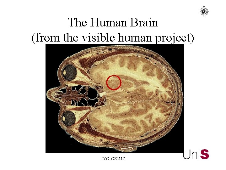 The Human Brain (from the visible human project) JYC: CSM 17 