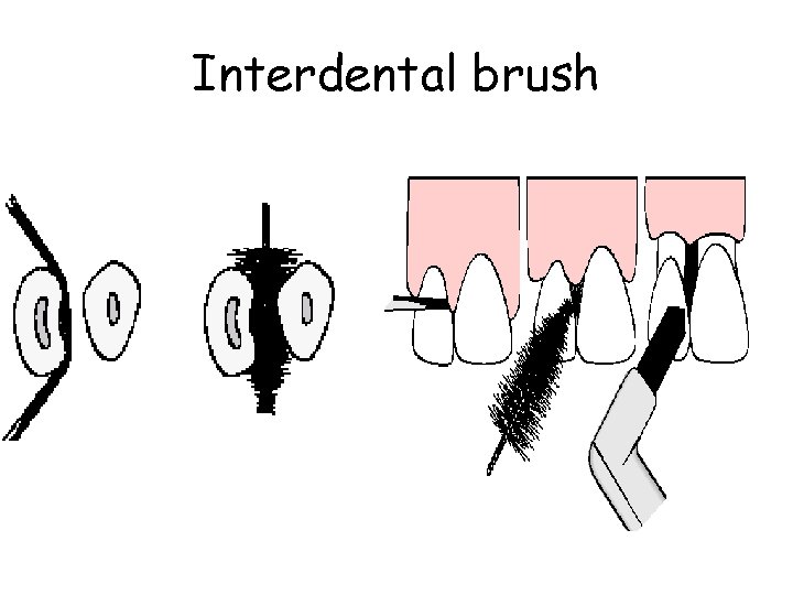 Interdental brush 