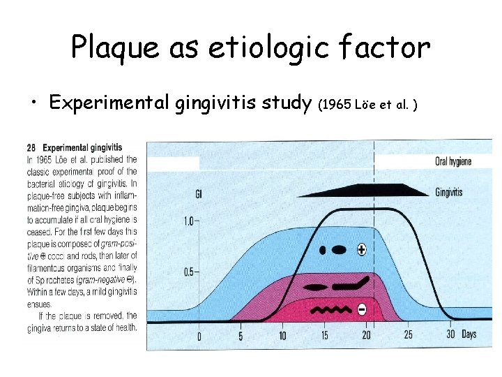 Plaque as etiologic factor • Experimental gingivitis study (1965 Löe et al. ) 