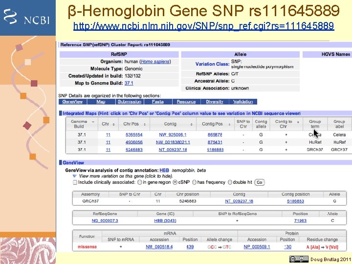 β-Hemoglobin Gene SNP rs 111645889 http: //www. ncbi. nlm. nih. gov/SNP/snp_ref. cgi? rs=111645889 Doug