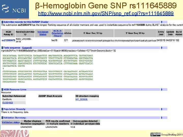 β-Hemoglobin Gene SNP rs 111645889 http: //www. ncbi. nlm. nih. gov/SNP/snp_ref. cgi? rs=111645889 Doug