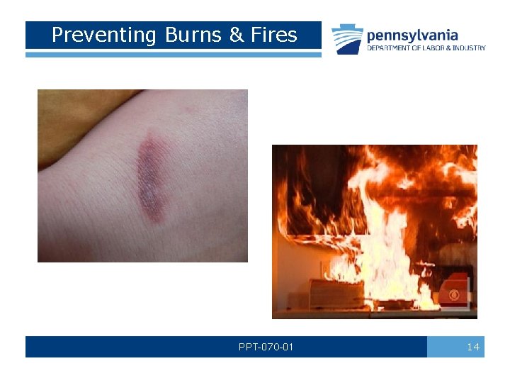 Preventing Burns & Fires PPT-070 -01 14 Preventing Burns & Fires PPT-070 -01 14