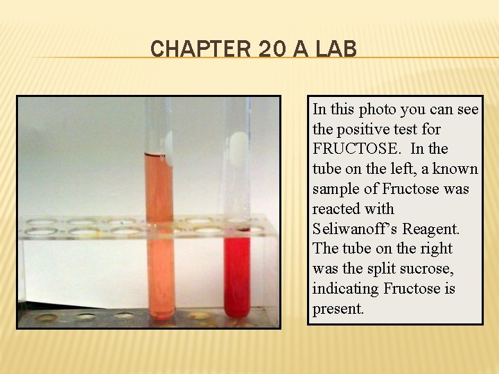 CHAPTER 20 A LAB In this photo you can see the positive test for