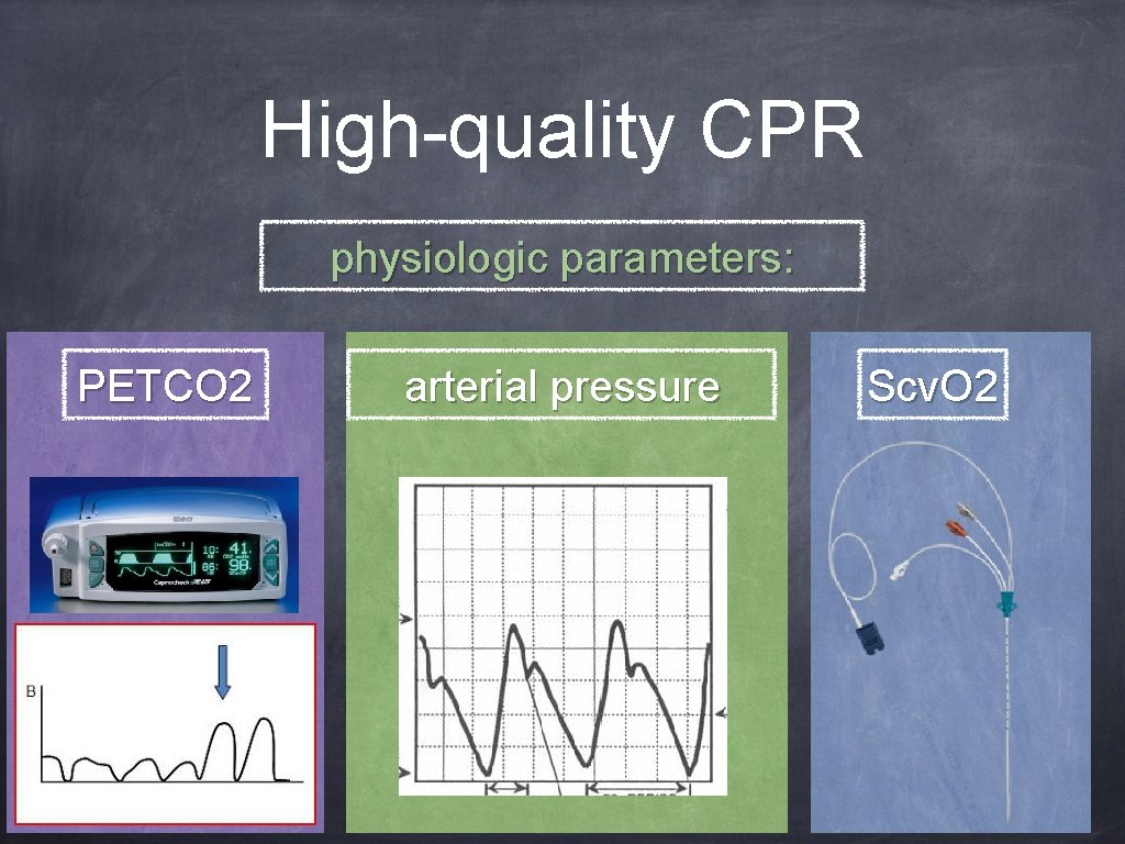 High-quality CPR physiologic parameters: PETCO 2 arterial pressure Scv. O 2 