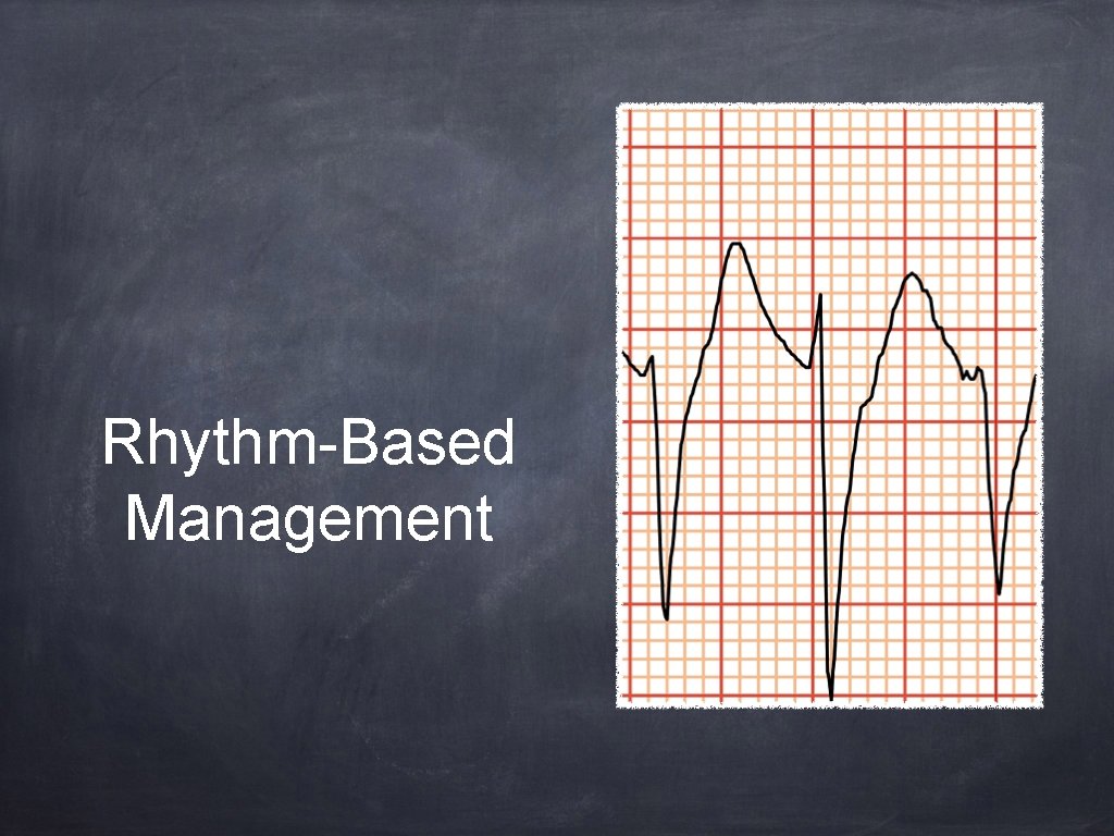 Rhythm-Based Management 