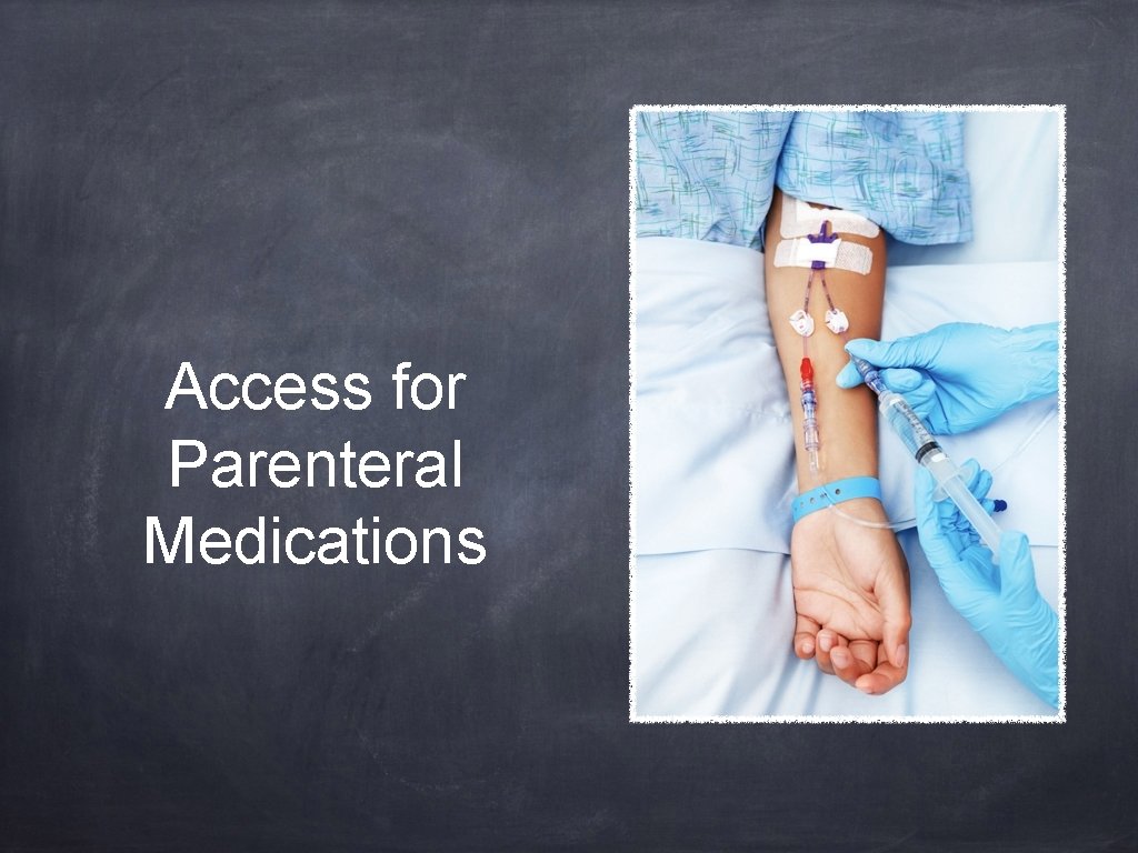 Access for Parenteral Medications 