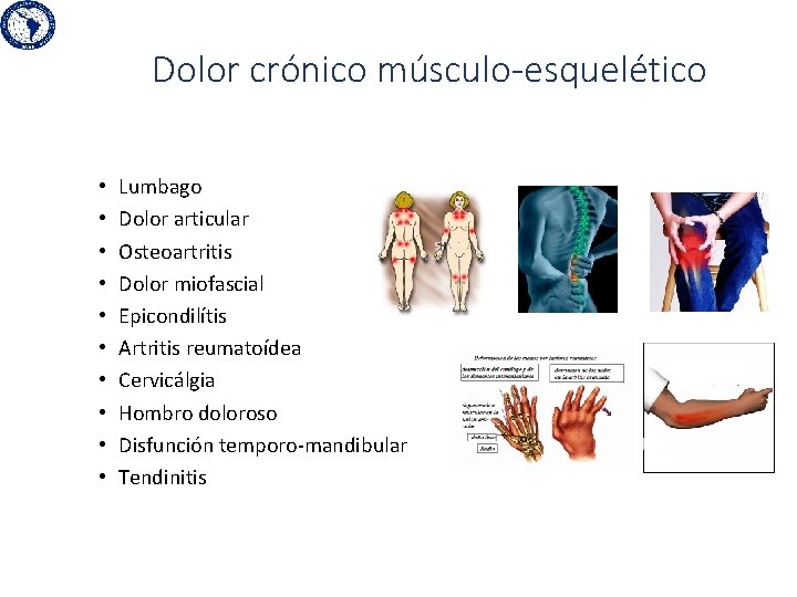 Dolor crónico músculo-esquelético • • • Lumbago Dolor articular Osteoartritis Dolor miofascial Epicondilítis Artritis