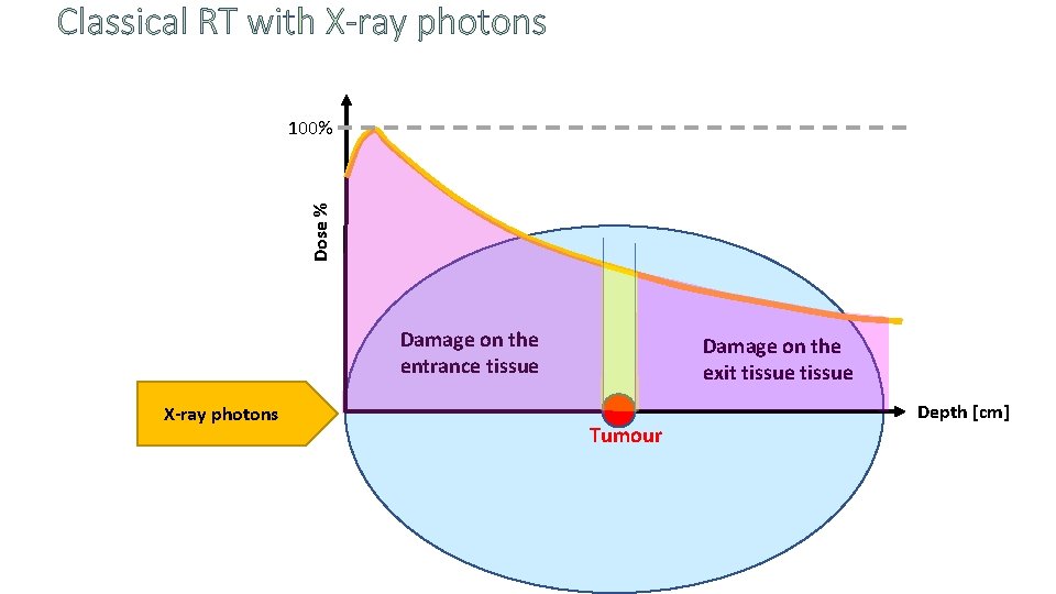 Classical RT with X-ray photons Dose % 100% Damage on the entrance tissue X-ray