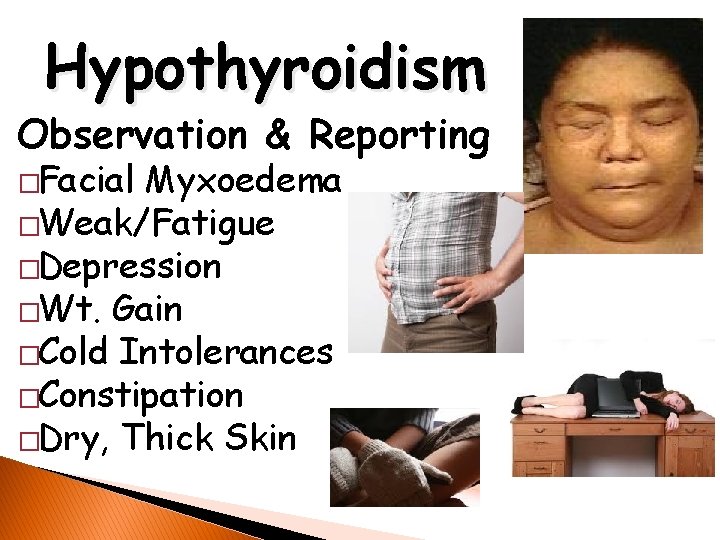 Hypothyroidism Observation & Reporting �Facial Myxoedema �Weak/Fatigue �Depression �Wt. Gain �Cold Intolerances �Constipation �Dry,