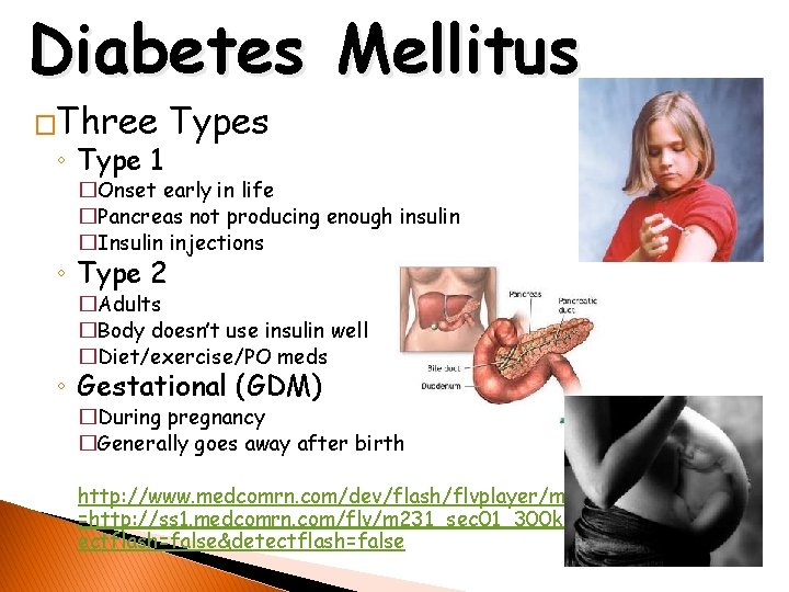 Diabetes Mellitus �Three ◦ Type 1 Types �Onset early in life �Pancreas not producing