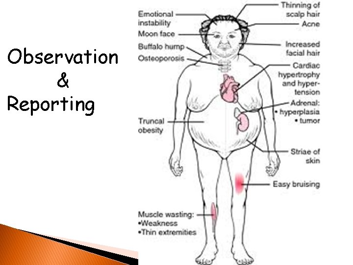 Observation & Reporting 