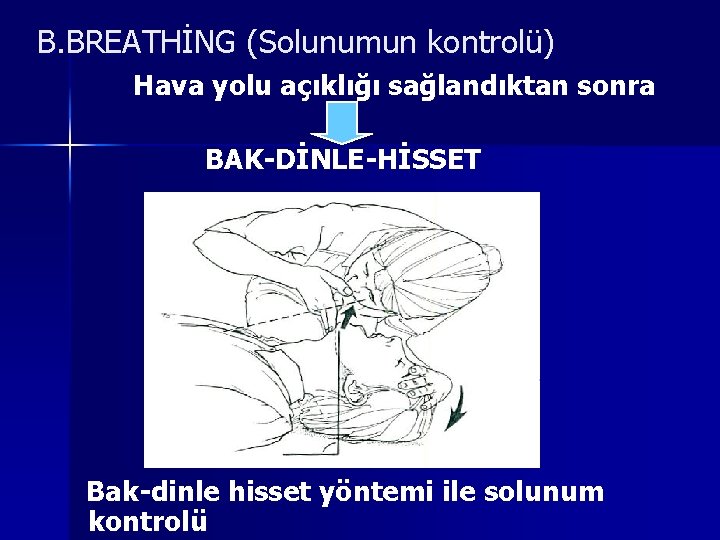B. BREATHİNG (Solunumun kontrolü) Hava yolu açıklığı sağlandıktan sonra BAK-DİNLE-HİSSET Bak-dinle hisset yöntemi ile