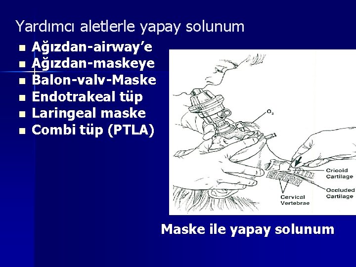 Yardımcı aletlerle yapay solunum n n n Ağızdan-airway’e Ağızdan-maskeye Balon-valv-Maske Endotrakeal tüp Laringeal maske