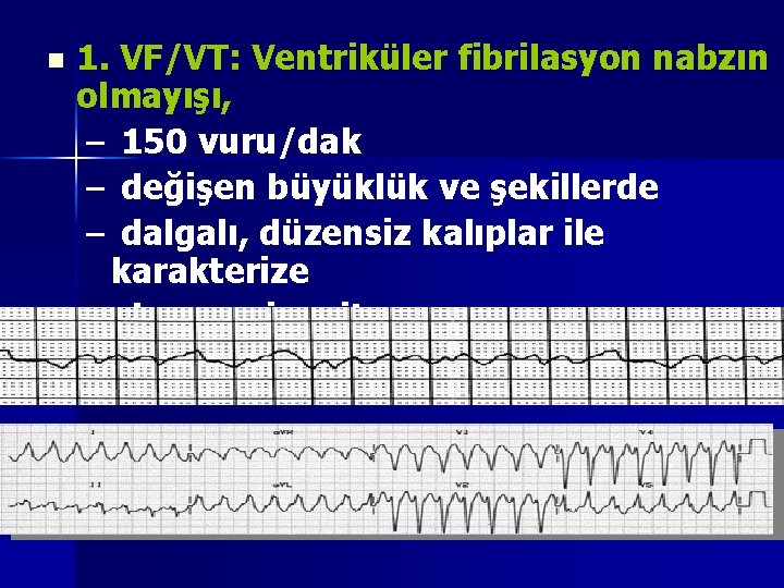 n 1. VF/VT: Ventriküler fibrilasyon nabzın olmayışı, – 150 vuru/dak – değişen büyüklük ve