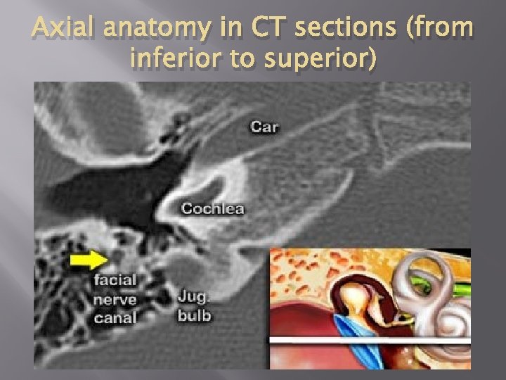 Axial anatomy in CT sections (from inferior to superior) 