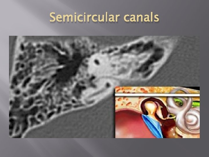 Semicircular canals 